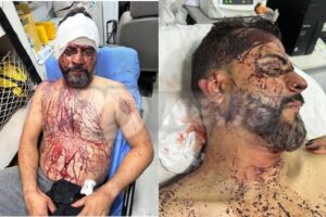 Vereador sofreu 3 horas de tortura e teve parte da orelha decepada