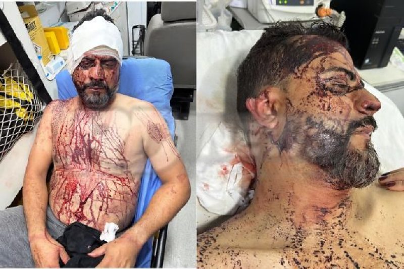 Vereador sofreu 3 horas de tortura e teve parte da orelha decepada